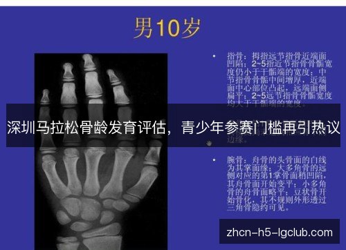 深圳马拉松骨龄发育评估，青少年参赛门槛再引热议